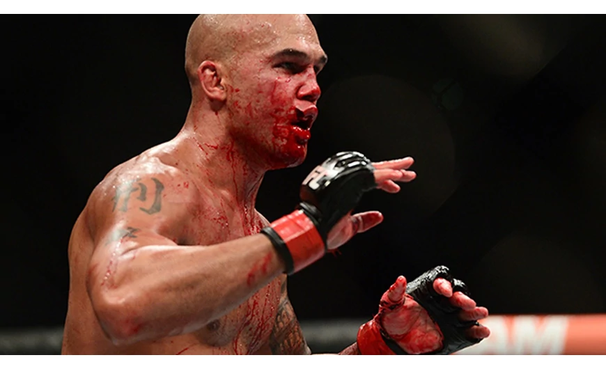 Itt a vége Robbie Lawler?