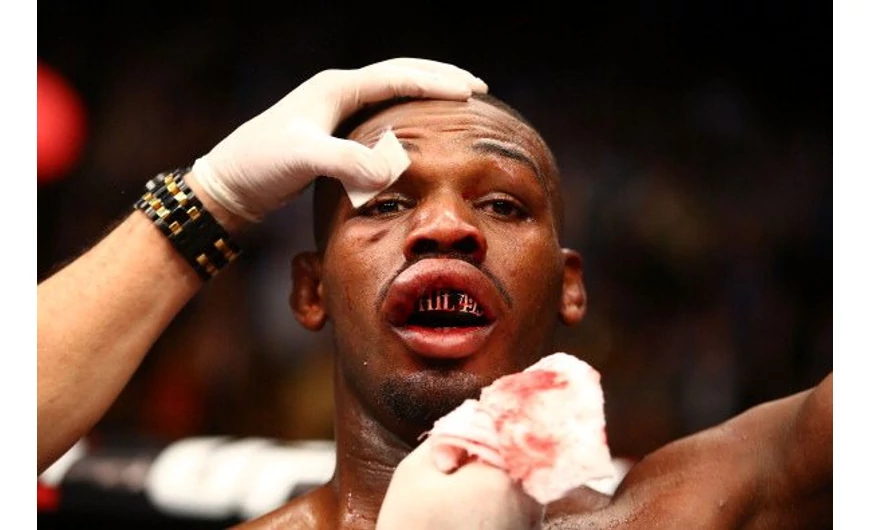 Jon Jones a fotelből harcol jelenleg.